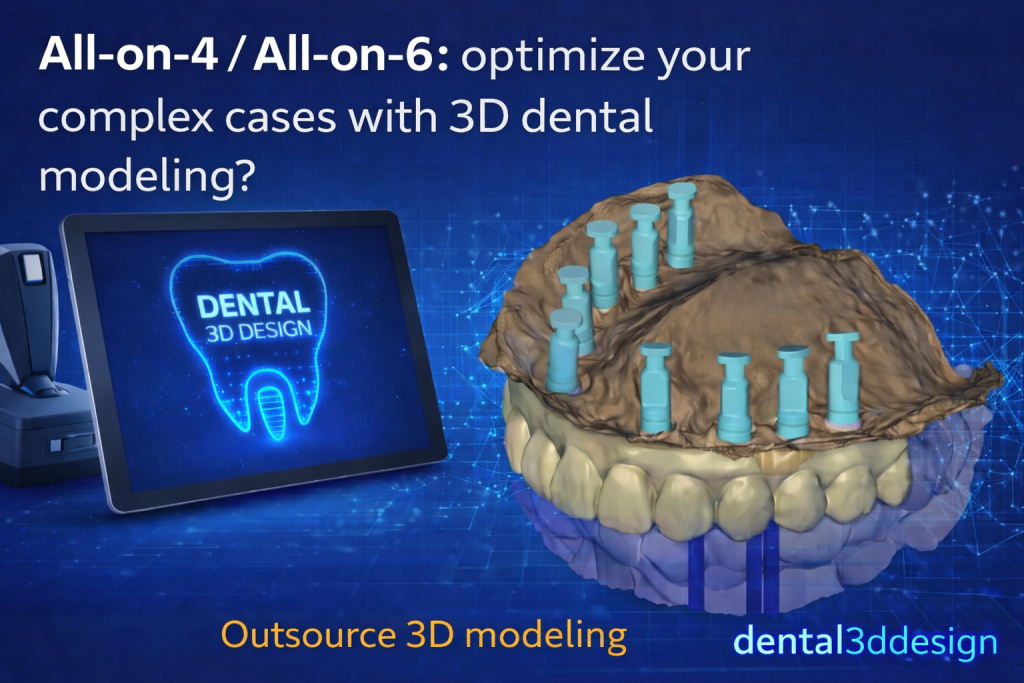 3D dental modeling for All-on-4 and All-on-6 implant cases — Digital workflow visualization by Dental3Ddesign showing implant positions and digital planning tools