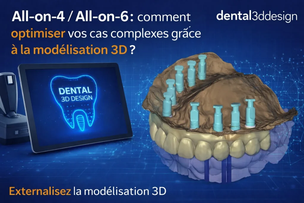 Affiche All-on-4 et All-on-6 en modélisation 3D Exocad – Dental3DDesign